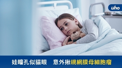 娃瞳孔似貓眼 意外揪視網膜母細胞瘤