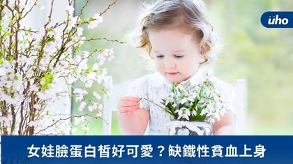女娃臉蛋白皙好可愛?缺鐵性貧血上身
