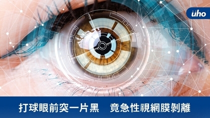 打球眼前突一片黑 竟急性視網膜剝離