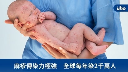 麻疹傳染力極強 全球每年染2千萬人