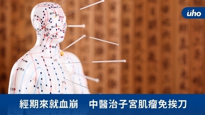 經期來就血崩 中醫治子宮肌瘤免挨刀