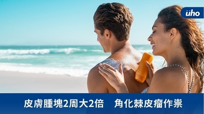 皮膚腫塊2周大2倍 角化棘皮瘤作祟