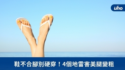 鞋不合腳別硬穿!4個地雷害美腿變粗