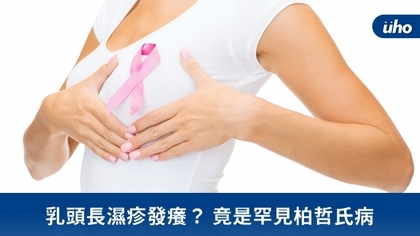 乳頭長濕疹發癢?竟是罕見柏哲氏病