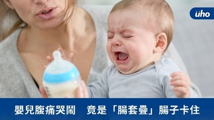 嬰兒腹痛哭鬧 竟是「腸套疊」腸子卡住