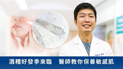 酒糟好發季來臨 醫師教你保養敏感肌