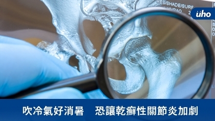 吹冷氣好消暑 恐讓乾癬性關節炎加劇