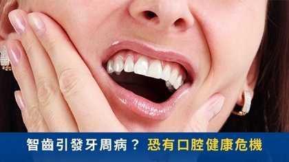 智齒引發牙周病? 恐有口腔健康危機