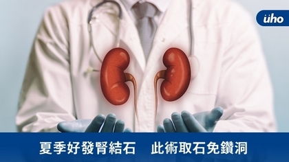 夏季好發腎結石 此術取石免鑽洞