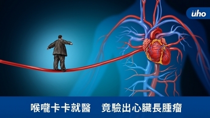 喉嚨卡卡就醫 竟驗出心臟長腫瘤