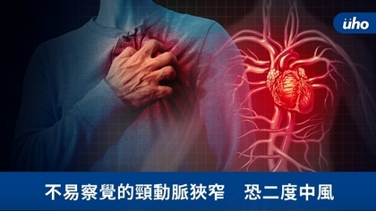 不易察覺的頸動脈狹窄 恐二度中風