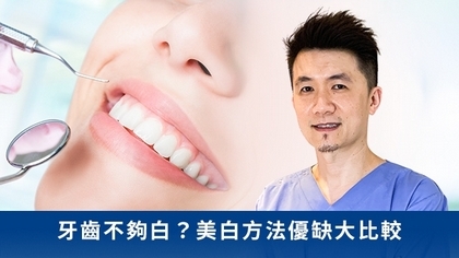 牙齒不夠白?美白方法優缺大比較