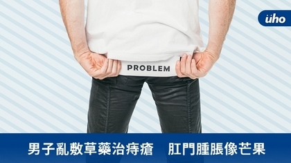 男子亂敷草藥治痔瘡 肛門腫脹像芒果