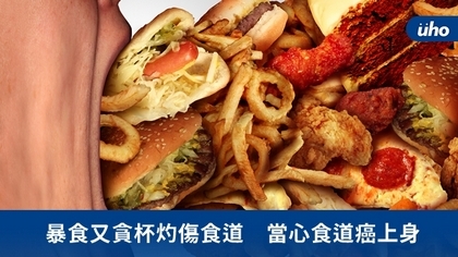 暴食又貪杯灼傷食道 當心食道癌上身