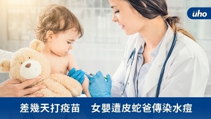 差幾天打疫苗 女嬰遭皮蛇爸傳染水痘