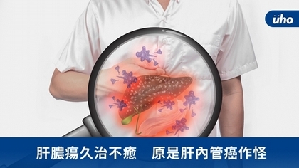肝膿瘍久治不癒 原是肝內管癌作怪