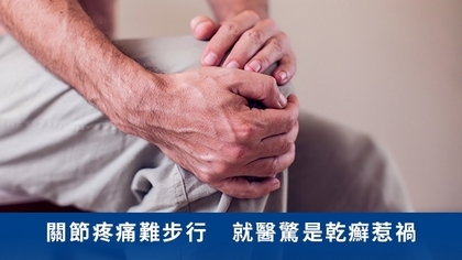 關節疼痛難步行 就醫驚是乾癬惹禍