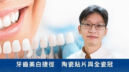 牙齒美白捷徑 陶瓷貼片與全瓷冠