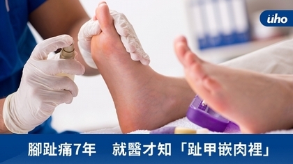 腳趾痛7年 就醫才知「趾甲嵌肉裡」