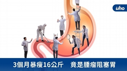 3個月暴瘦16公斤 竟是腫瘤阻塞胃