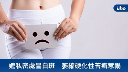嬤私密處冒白斑 萎縮硬化性苔癬惹禍