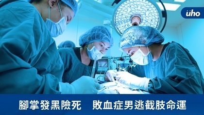 腳掌發黑險死 敗血症男逃截肢命運