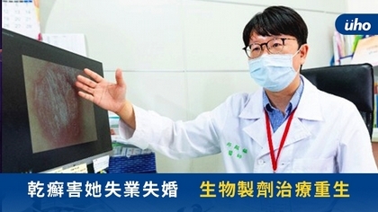 乾癬害她失業失婚 生物製劑治療重生