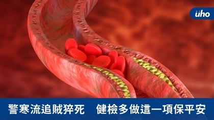 警寒流追賊猝死 健檢多做這一項保平安