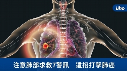 注意肺部求救7警訊 這招打擊肺癌