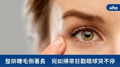 整排睫毛倒著長 宛如掃帚狂戳眼球哭不停