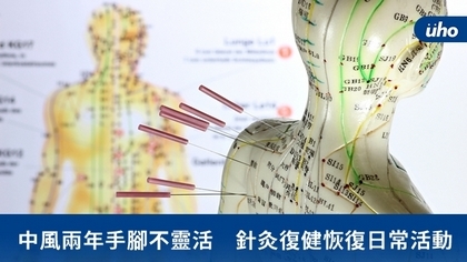 中風兩年手腳不靈活 針灸復健恢復日常活動