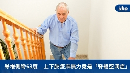 脊椎側彎63度 上下肢痠麻無力竟是「脊髓空洞症」
