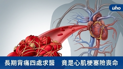 長期背痛四處求醫 竟是心肌梗塞險喪命