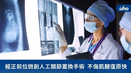 經正前位微創人工關節置換手術 不傷肌腱復原快