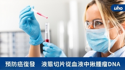 預防癌復發 液態切片從血液中揪腫瘤DNA