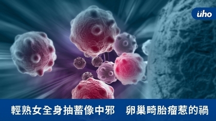 輕熟女全身抽蓄像中邪 卵巢畸胎瘤惹的禍