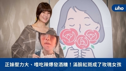 正妹壓力大、嗜吃辣爆發酒糟!滿臉紅斑成了玫瑰女孩
