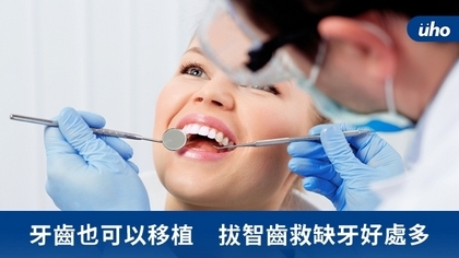 牙齒也可以移植 拔智齒救缺牙好處多