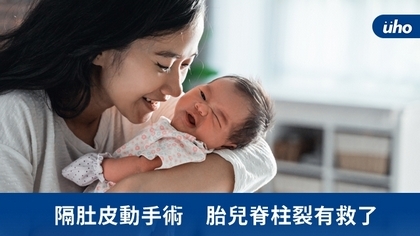 隔肚皮動手術 胎兒脊柱裂有救了
