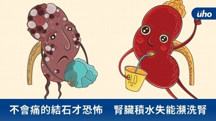 不會痛的結石才恐怖 腎臟積水失能瀕洗腎