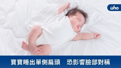 寶寶睡出單側扁頭 恐影響臉部對稱