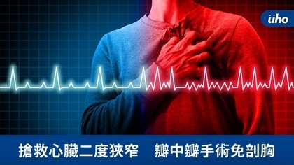 搶救心臟二度狹窄 瓣中瓣手術免剖胸