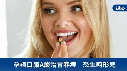 孕婦口服A酸治青春痘 恐生畸形兒