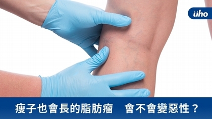瘦子也會長的脂肪瘤 會不會變惡性?