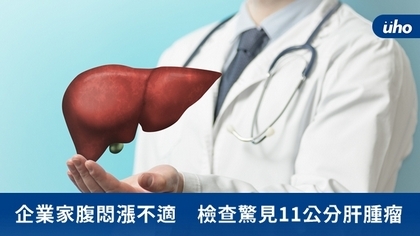 企業家腹悶漲不適 檢查驚見11公分肝腫瘤