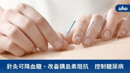 針灸可降血糖、改善胰島素阻抗 控制糖尿病