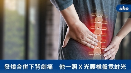 發燒合併下背劇痛 他一照X光腰椎盤竟蛀光