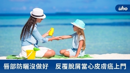 唇部防曬沒做好 反覆脫屑當心皮膚癌上門