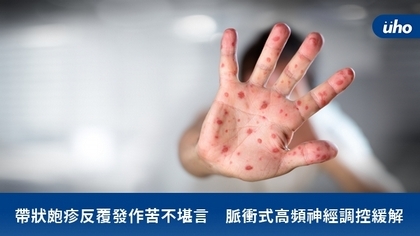 帶狀皰疹反覆發作苦不堪言 脈衝式高頻神經調控緩解
