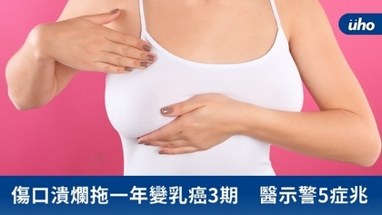 傷口潰爛拖一年變乳癌3期 醫示警5症兆